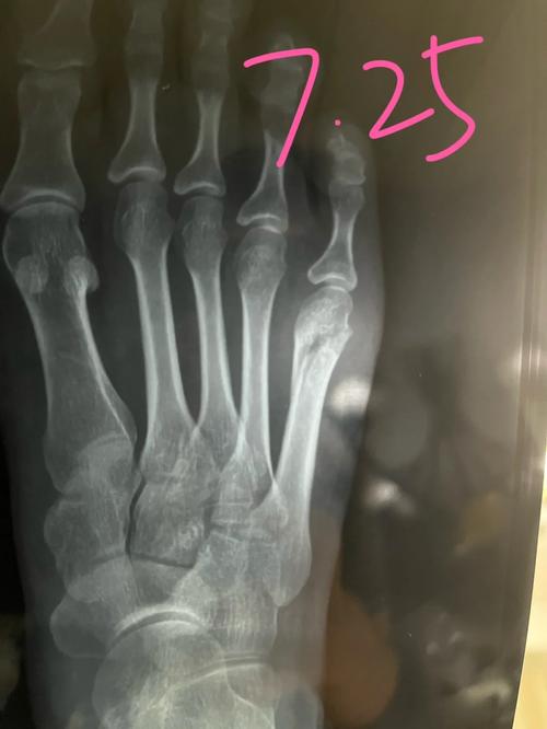 新澳今天晚上9点30分开门吗香港和被狗主人殴打致骨折与狗被打骨折了怎么办