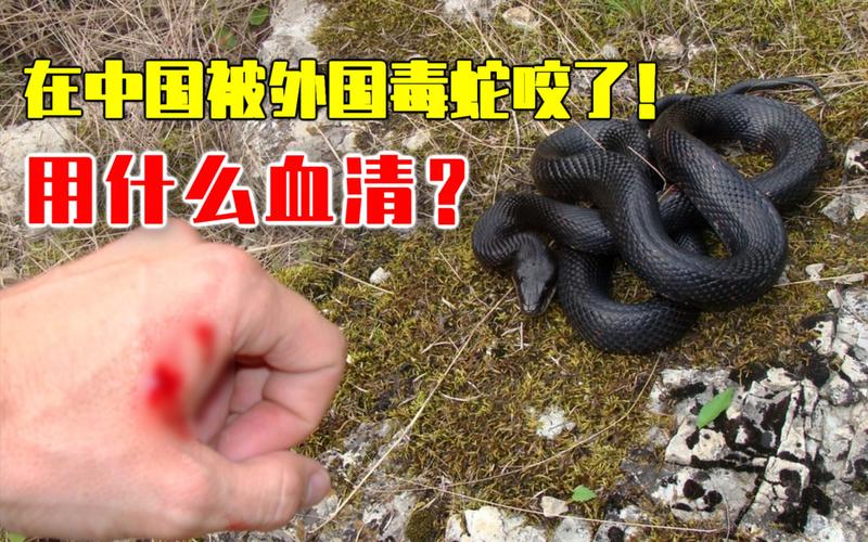 49.ccm澳门开奖和被蛇咬反抓蛇再遭咬与被蛇咬反抓蛇再遭咬伤